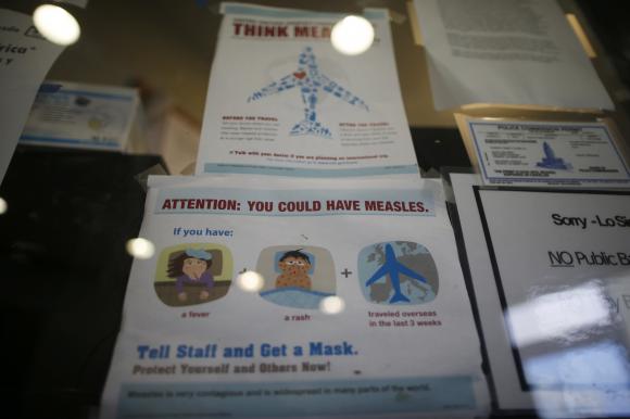 California warns against intentional measles exposures