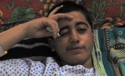 Peshawar school massacre: Injured student undergoes surgery in Birmingham