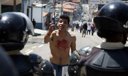 Venezuelan teen dies after being shot at anti-Maduro protest