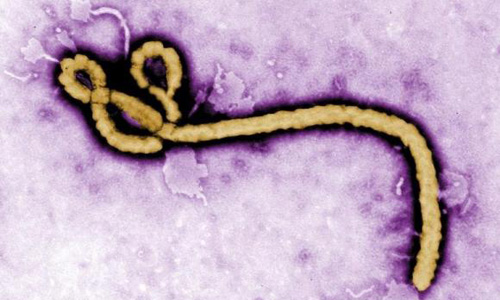 Two experimental Ebola vaccines pass safety test in African trial