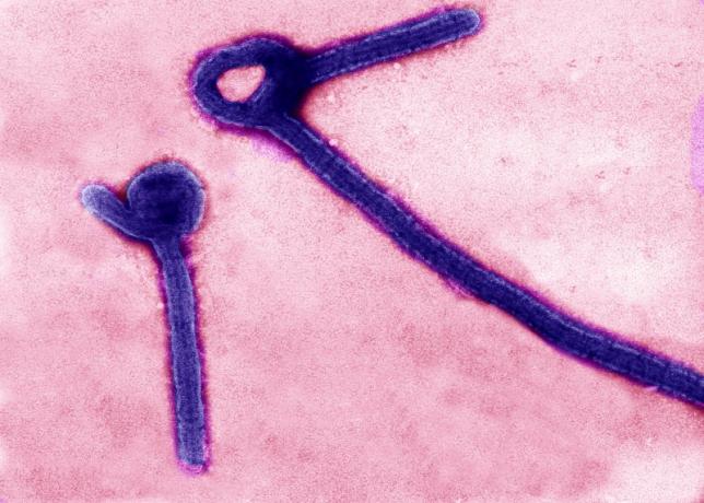 Patient tests negative for Ebola in US