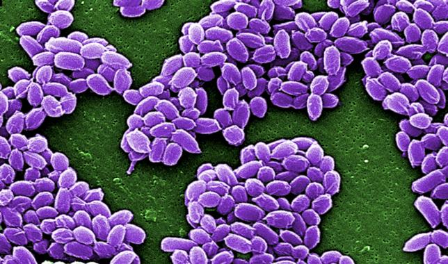 US military orders review as anthrax mishap widens