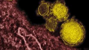 UK checking two suspected MERS cases in northern England