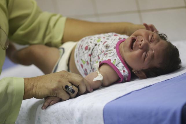 Deformed babies also suffering eye damage linked to Zika in Brazil