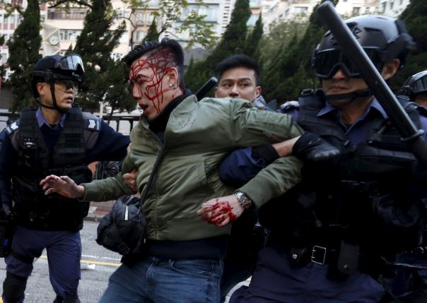 Hong Kong riot police fire warning shots in bloody street clashes