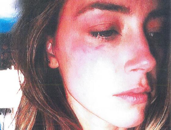 Amber Heard accuses estranged husband Johnny Depp of domestic violence