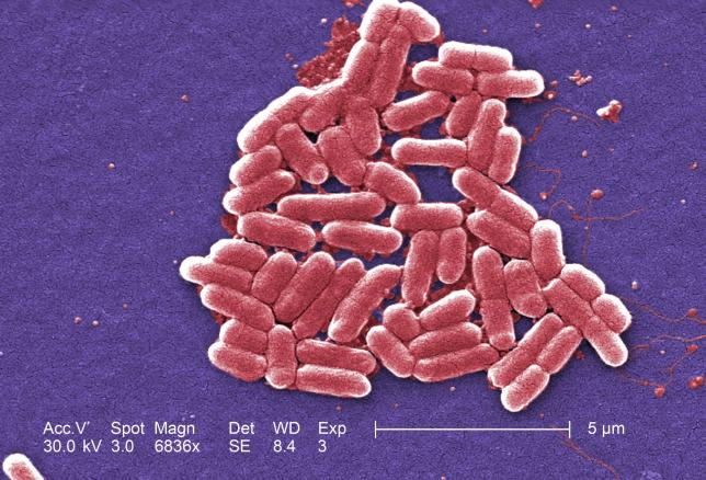 New incentives needed to develop antibiotics to fight superbugs