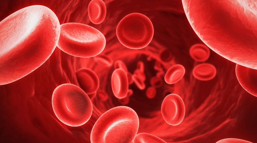Anemia tied to worse survival odds after stroke