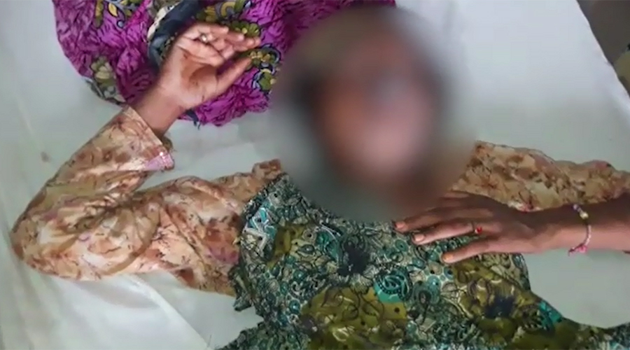 Woman’s nose, lips chopped off over domestic dispute in Layyah