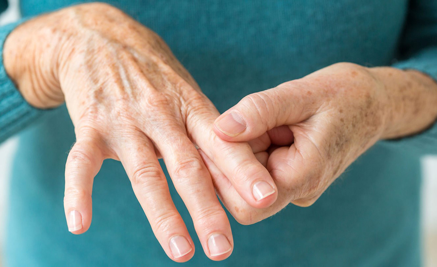 Cracking, popping joints may foretell arthritis