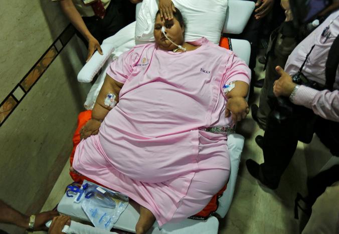 Egyptian woman leaves Indian hospital more than 300 kg lighter