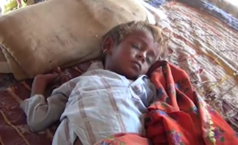 Six children die of measles in Umarkot