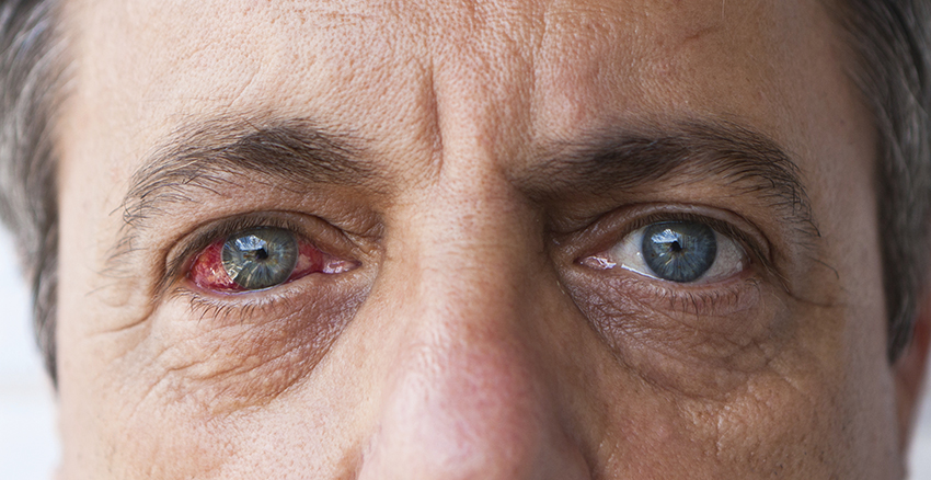 Diabetics with related eye damage have increased falling risk