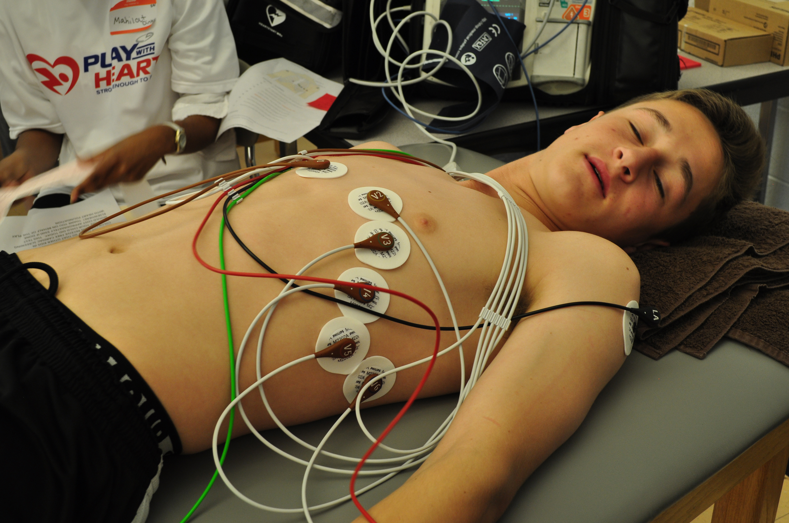 Cardiac arrest study in young athletes raises heart screening questions