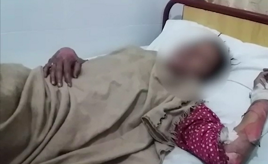 19-year-old girl set on fire for refusing marriage proposal in Phalia