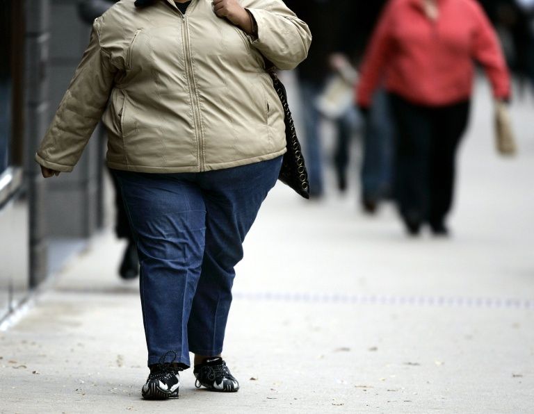 Study challenges 'healthy but obese' theory