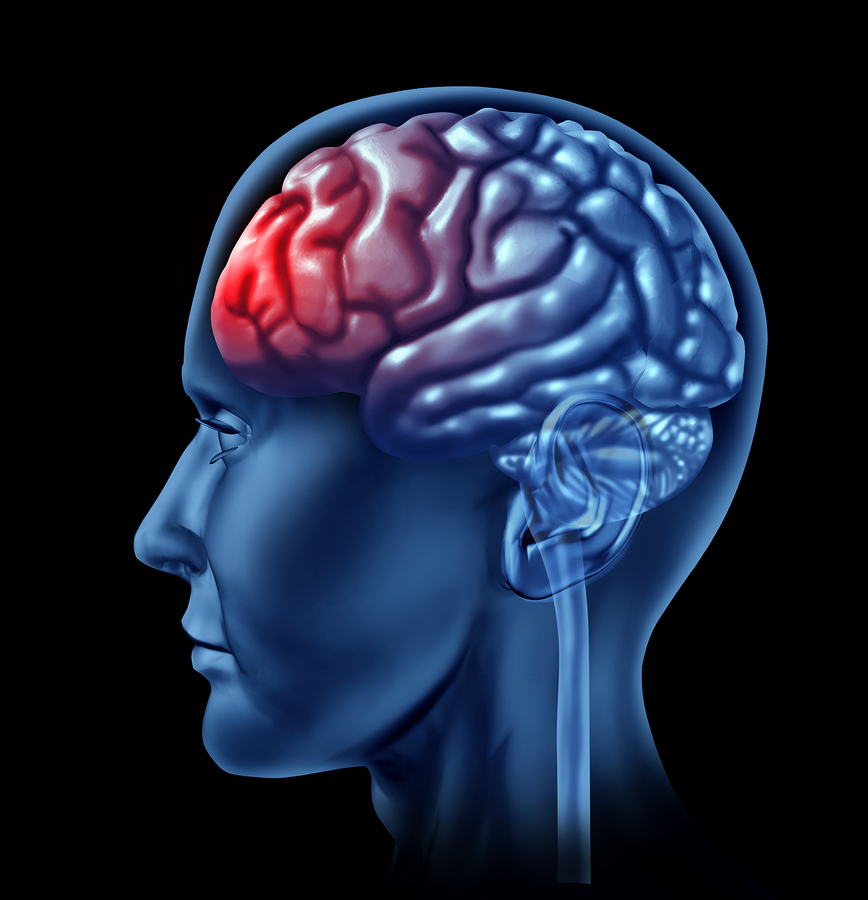 Many people with mild brain injuries don't get follow-up care