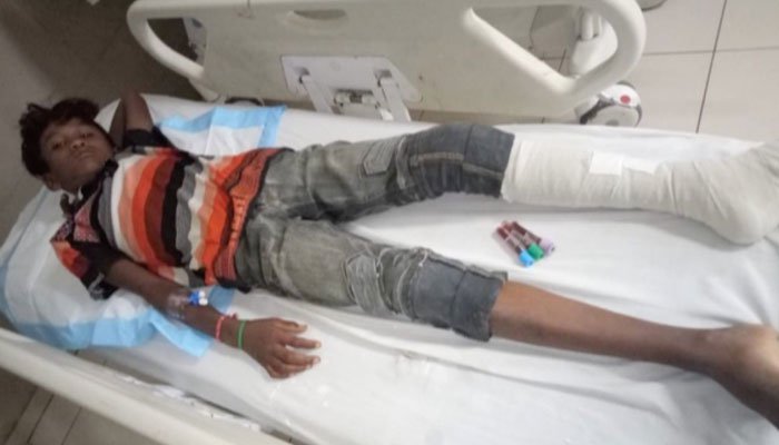 Another stray bullet incident leaves child injured in Karachi