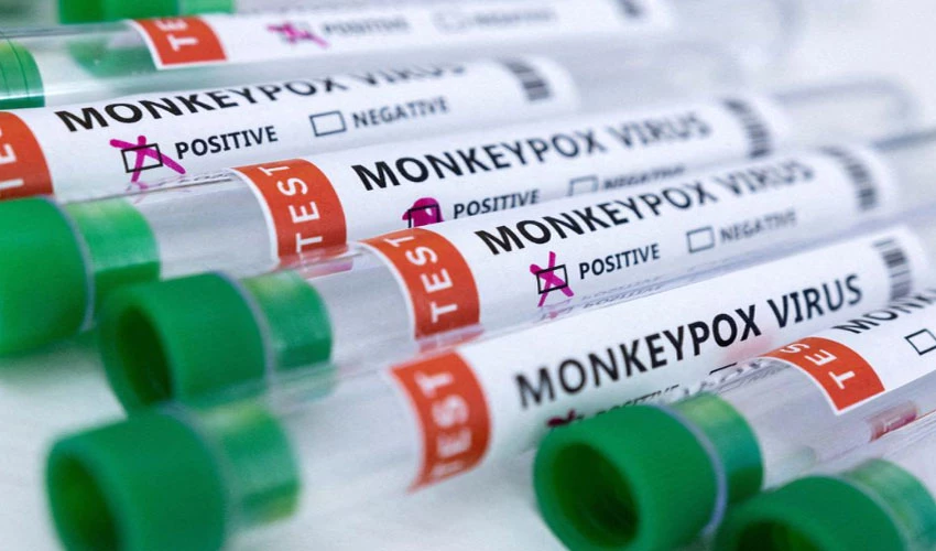 WHO declares global health emergency over monkeypox outbreak