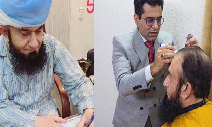 Maulana Tariq Jamil undergoes hair transplant?